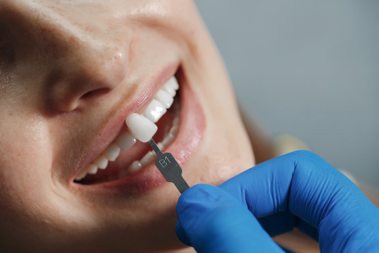 Dental implant treatment